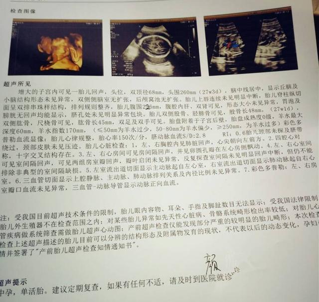 身为产科护士的我, 刚做的大排畸, 看男女这么看