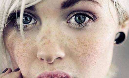 3个方法阻止黑色素沉着,让你脸上斑点早点下