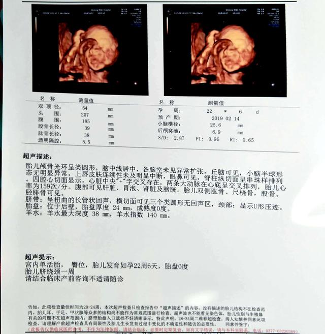 宝宝四维彩超照片很丑，原来是这2个原因，孕妇破涕为笑了