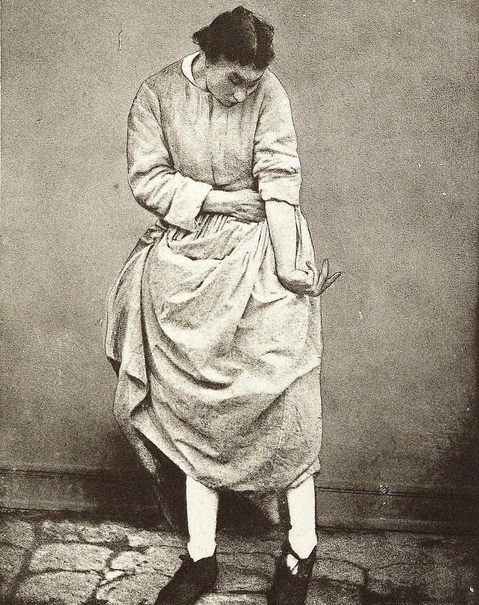 精神病院治疗歇斯底里女病人 恐怖照片曝光