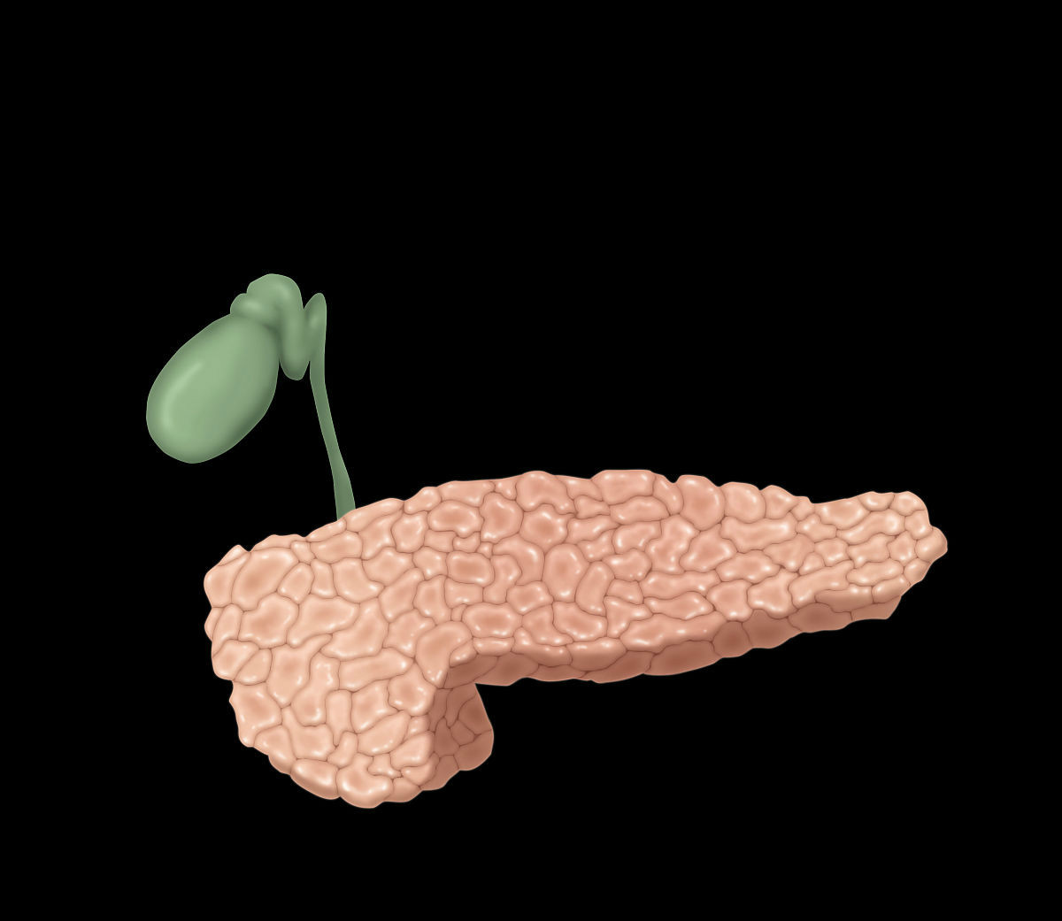 三种胆囊息肉一定要及时切除,拖久了会变成恶