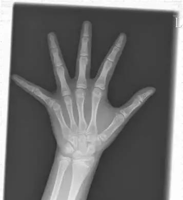 月经初潮了,孩子身高还能长多少?长知识了