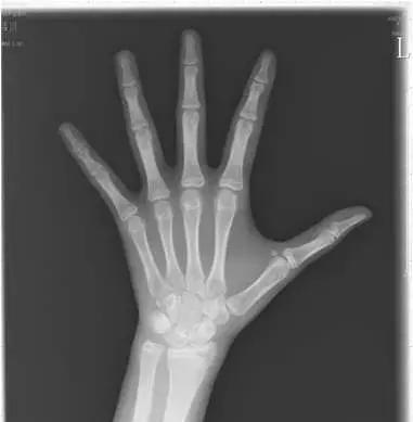 月经初潮了,孩子身高还能长多少?长知识了