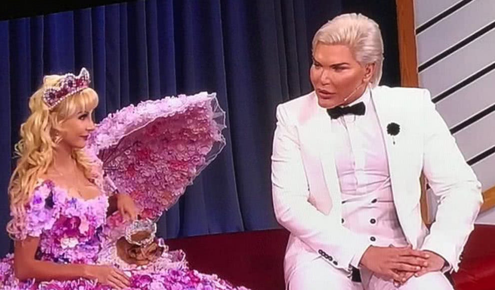 整容狂魔罗德里戈花费400万整成男芭比,真容惨不忍睹