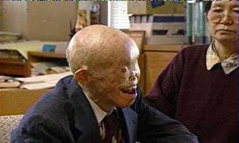 恶有恶报: 你没见过的广岛长崎遭核打击现场图