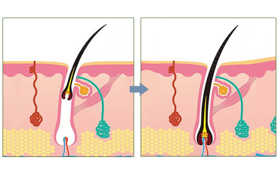 法尔加养发液可生发黑发吗?
