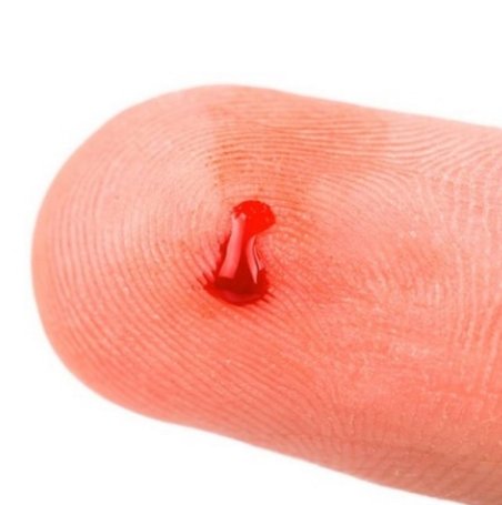 突发中风扎手指放血救命,有科学依据吗!