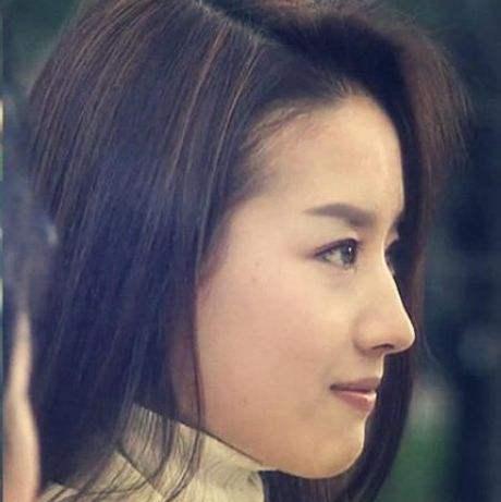 驼峰鼻是什么,刘亦菲喜欢娜扎要磨平?盘点有驼