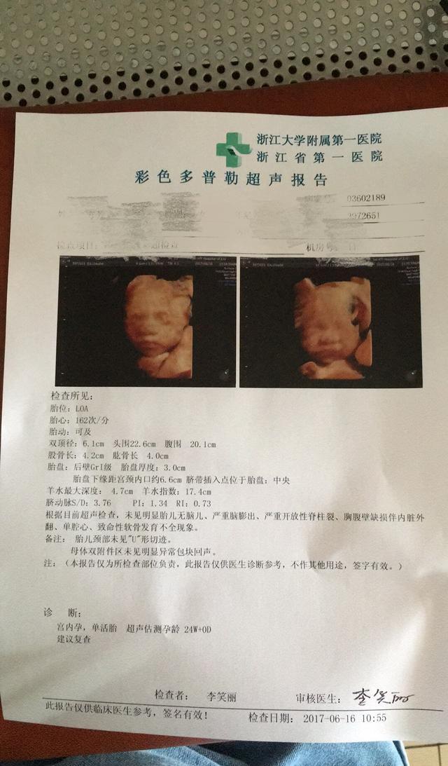 孕期必做的超声B超检查-顺产男宝宝,附B超检查