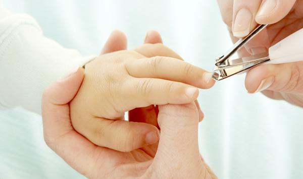 宝宝指甲太长怎么办, 总是抓脸要不要戴手套?