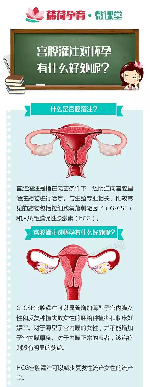 宫腔灌注对怀孕的好处,快来了解下…