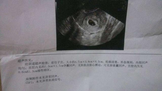 怀孕期间出现这6种症状 生男孩的几率比较大