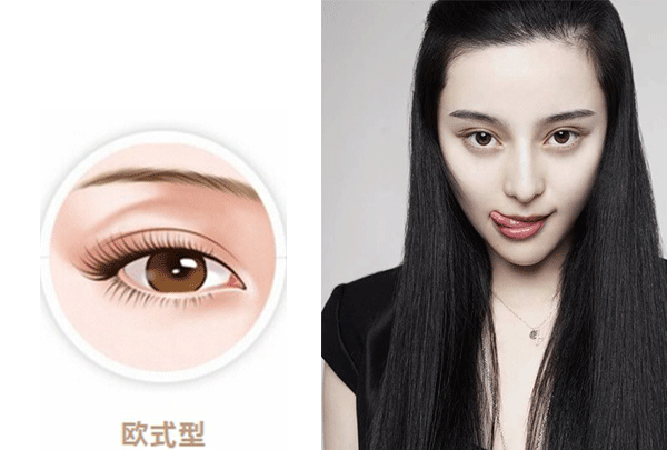 各脸型女星双眼皮贴出新高度|双眼皮贴|双眼皮|扇形