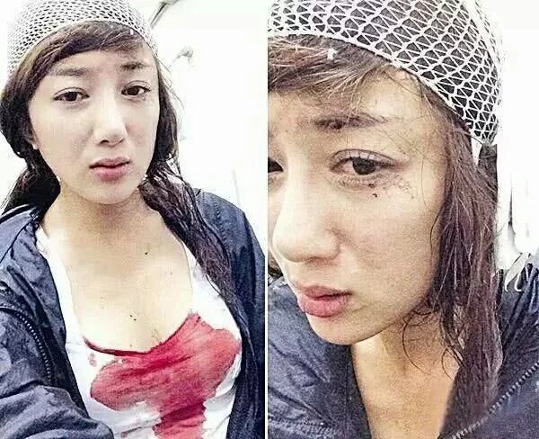 她坦言一共整容5次,在剧中常演心机美女,曾被狗咬了缝