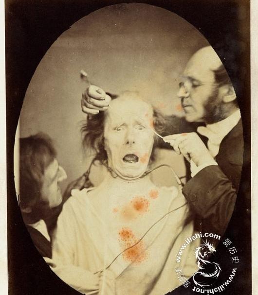 老照片: 达尔文最后实验的恐怖照片