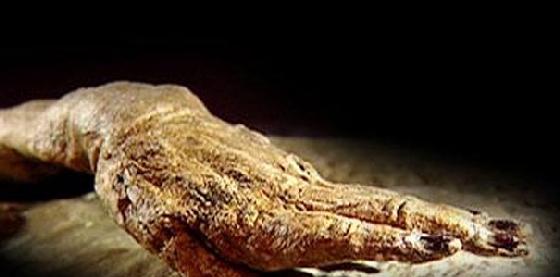 2000年不腐辛追夫的人,因为138颗瓜子而死,症状现在普遍!