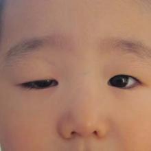 3岁宝宝患上重症肌无力,原因让所有人大吃一惊