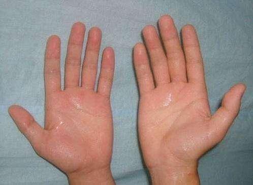 手脚出汗如雨下,医生建议:心阴虚,要多吃这3种