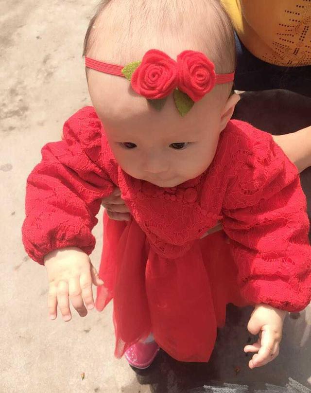 7个月宝宝头发少得可怜, 宝妈心急如焚, 没头发