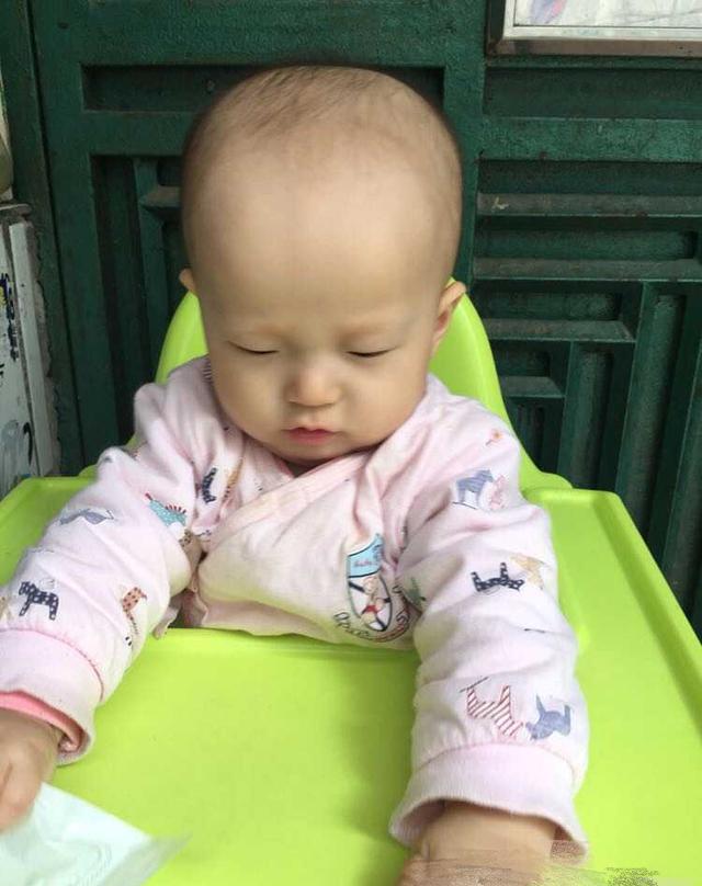 7个月宝宝头发少得可怜, 宝妈心急如焚, 没头发