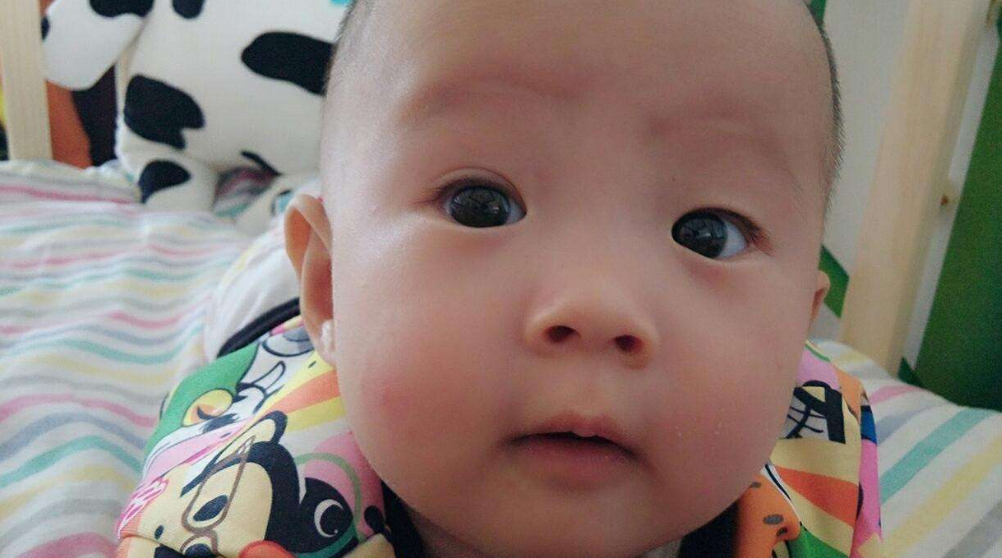 对婴说一二三:宝宝变双眼皮前的征兆