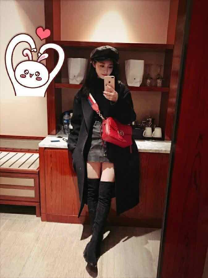 周洁琼因腿上微博热搜,网友:我以为是因为腿粗