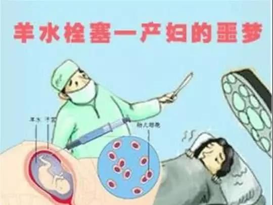 刘强东妹妹因羊水栓塞去世，羊水栓塞称为“产妇噩梦”真的很可怕