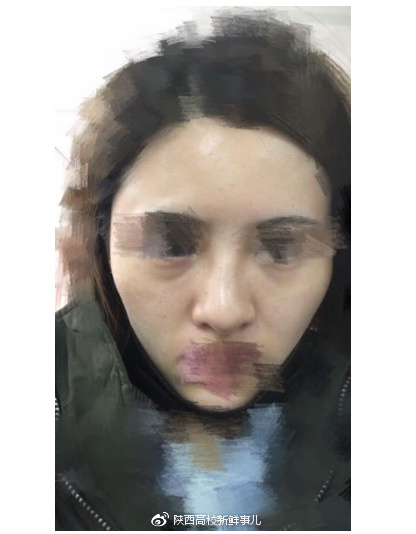 西安一女子遭遇莆田系医院毁容,医院放话说后