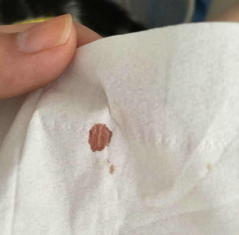 棉布的血渍怎么洗掉?