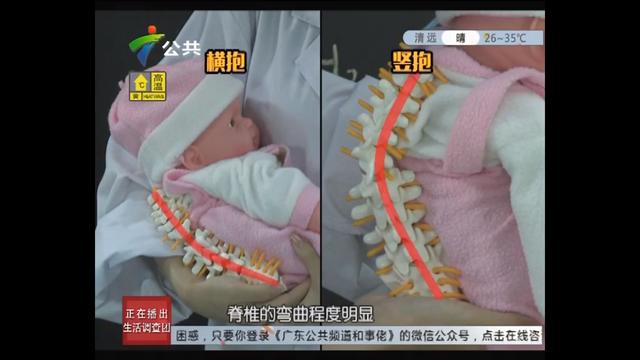 导致宝宝斜颈是因为这个?照顾宝宝的你前三个