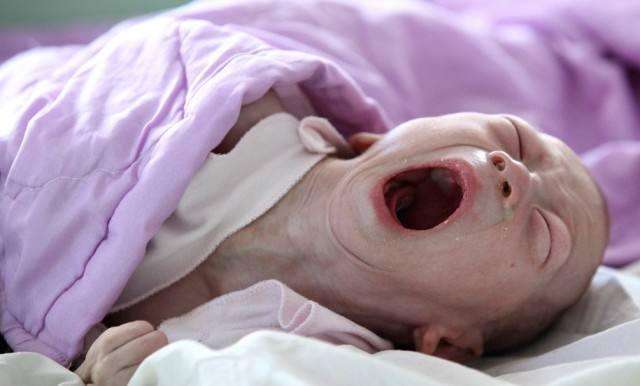 孕妇剖腹产打麻药不管用,痛的不想要孩子,医生