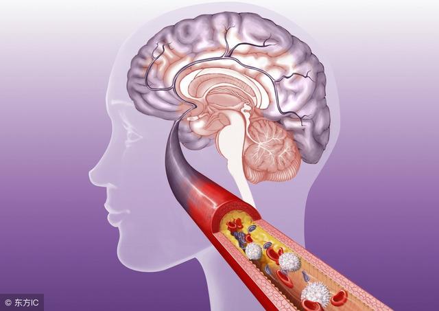 年龄增大血压跟着增加,脉压差还越来越大!这种