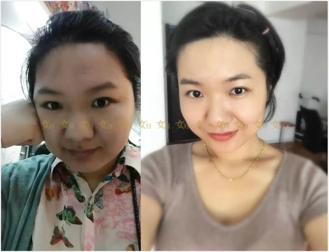减肥前vs减肥后不能照你们对比下!喂母乳感受穿塑身衣吗图片
