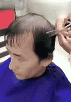高额头发质细头发还少的男生该理什么发型？