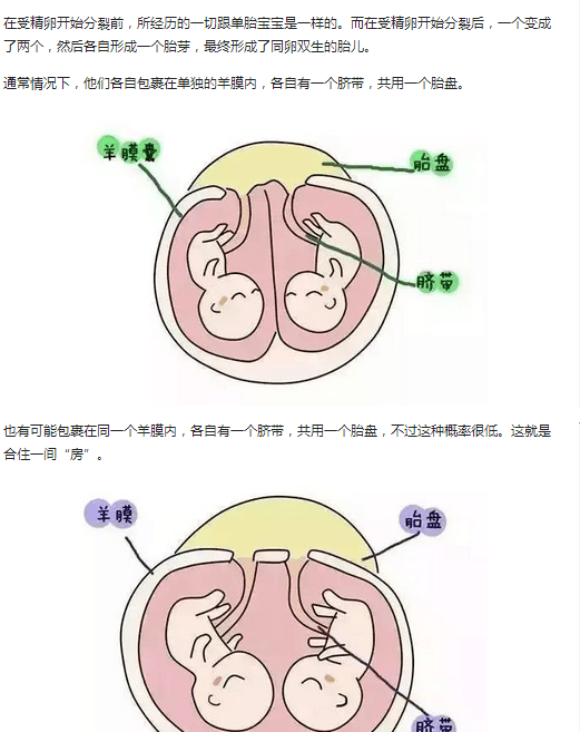 双胞胎在妈妈肚子里是什么样的?