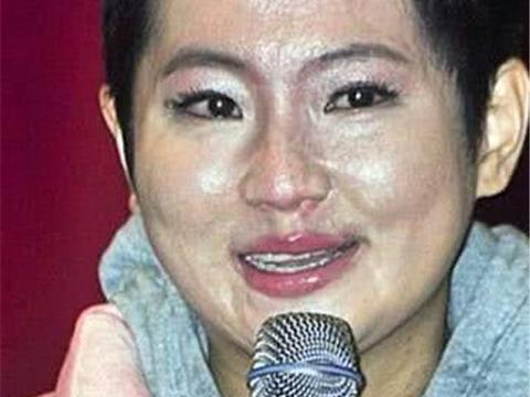 凭SHE出道却遭毁容，丈夫还出轨李宗瑞前女友，今坐奔驰成这般！