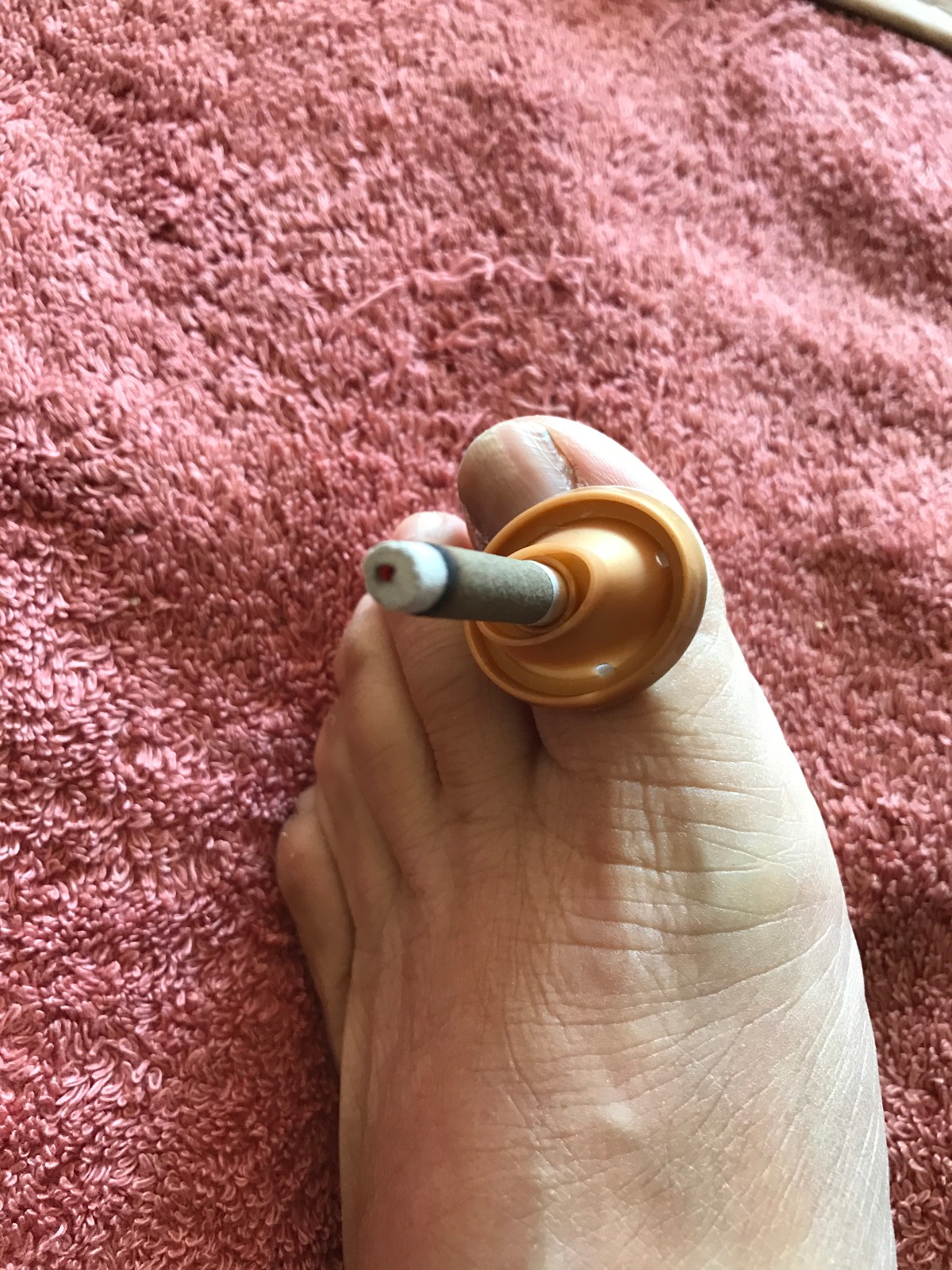 艾灰的妙用,你了解多少?