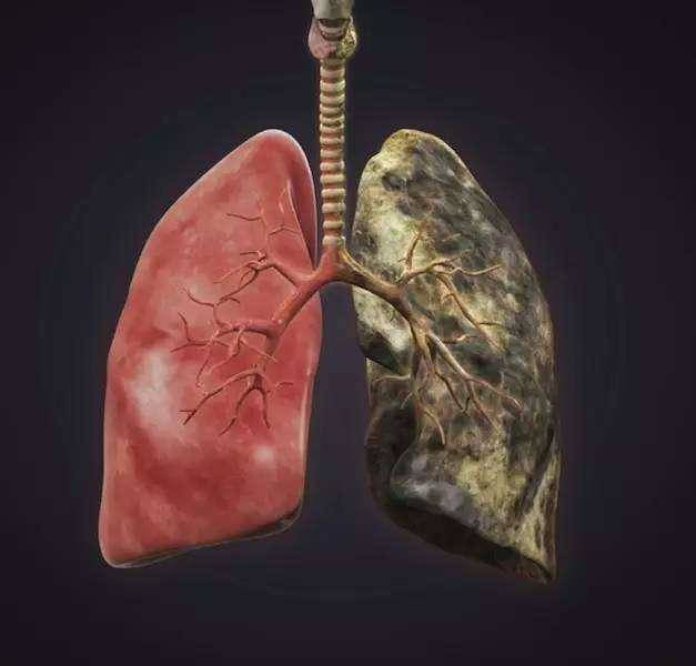 长期吸烟戒烟后肺还恢复到正常人的水平吗