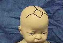 别急!婴儿头顶上的卤门闭合时间现在就告诉你