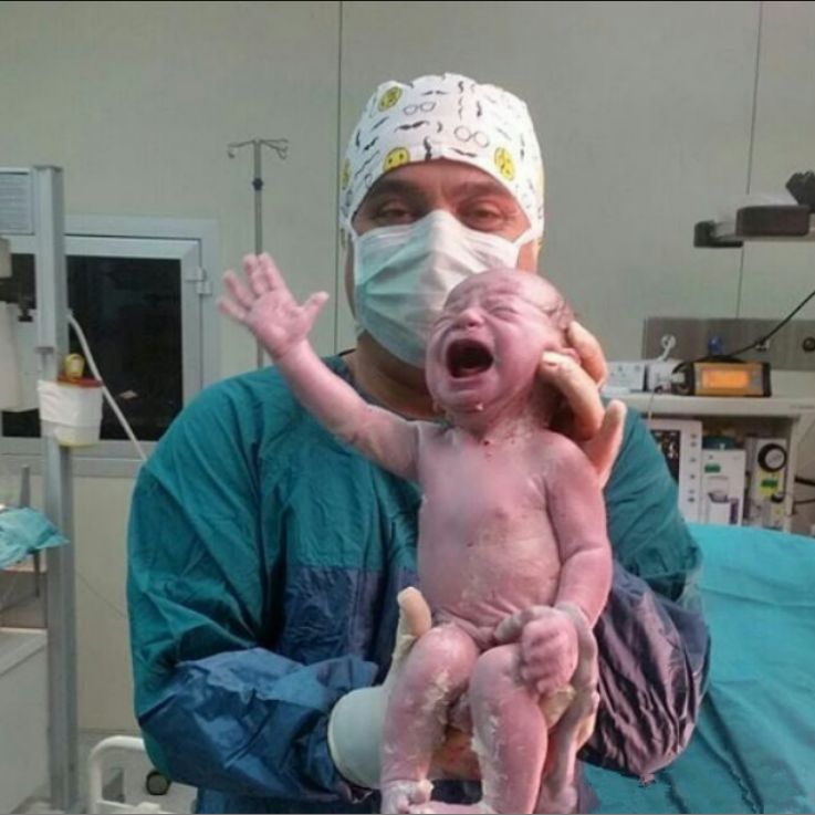图为刚刚出生的宝宝,医生举托着婴儿,小家伙已经很有力气大哭了