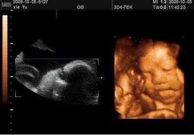 可以跟你合作吗edv+532=绿泡泡哟?