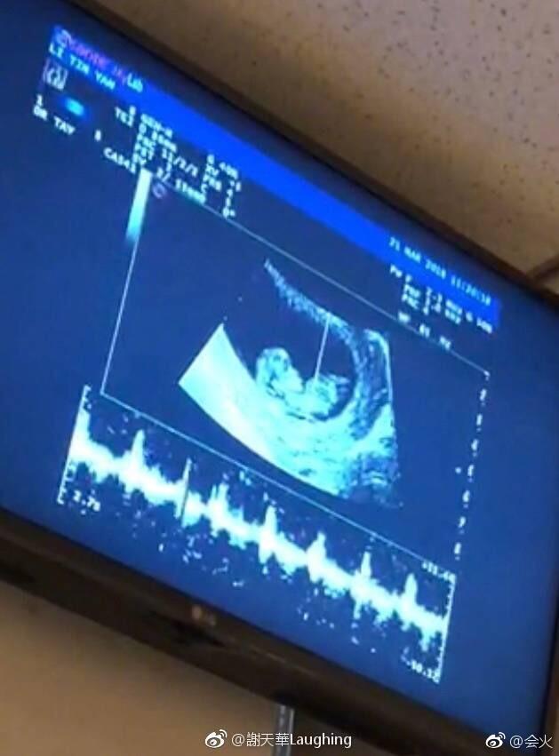 又有一位明星生二胎!丁俊晖升级当爸,球迷:斯诺