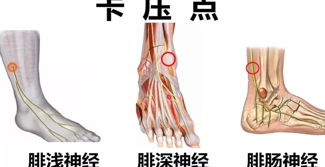 精进专题神经篇腓总神经