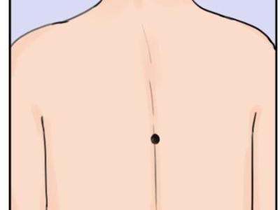 算命的说身上这4个部位长痣无论男女十人九贵一生福报多