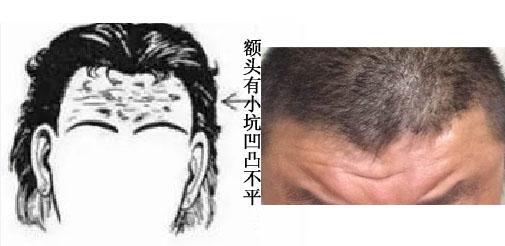 面相中6种常见的额头劣相，你见过几个？