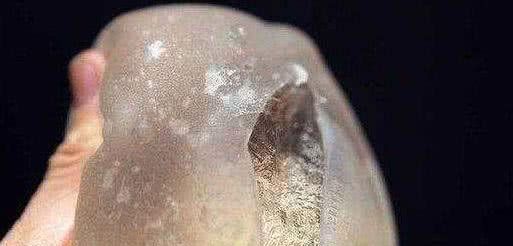 蒸桑拿后女子发现自己胸不见了!去医院检查