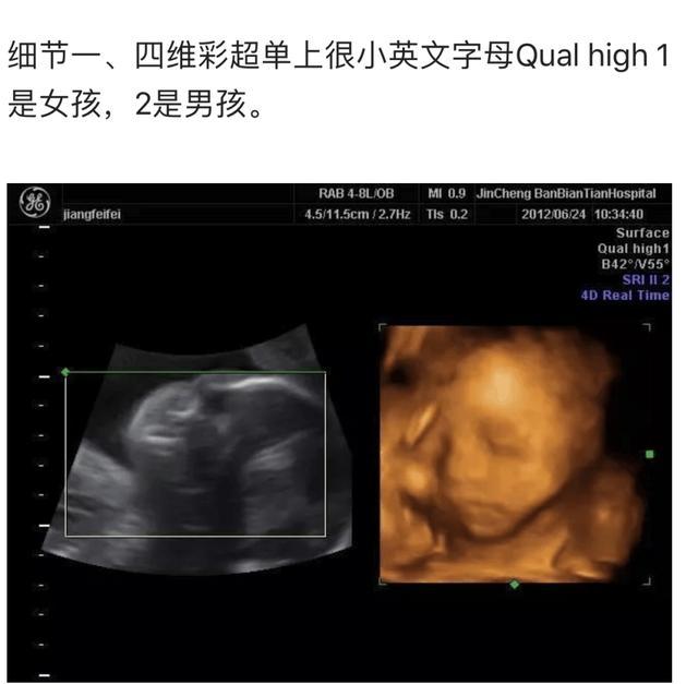 四维彩超到底怎么看?这些细节,其实已经透露了胎儿性别!