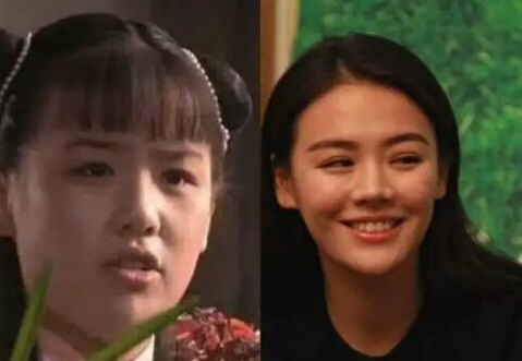 割过双眼皮后，戚薇长颜值周迅变妩媚，马思纯直接起到了整容效果