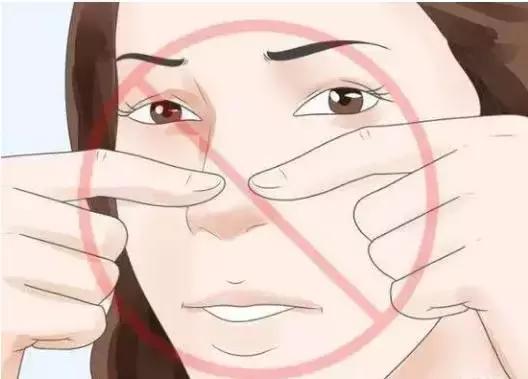 鼻子上挤出来的白点点,是什么?教你正确处理