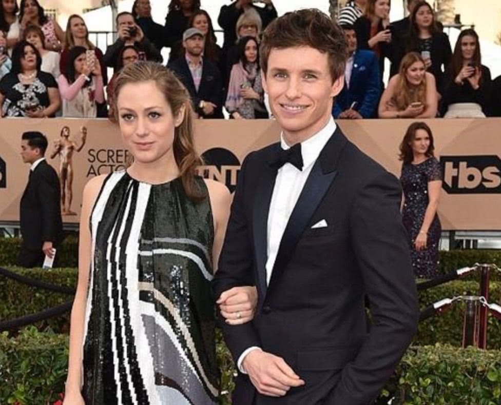 小雀斑二胎得子,被指霍金转世!难道这就是传